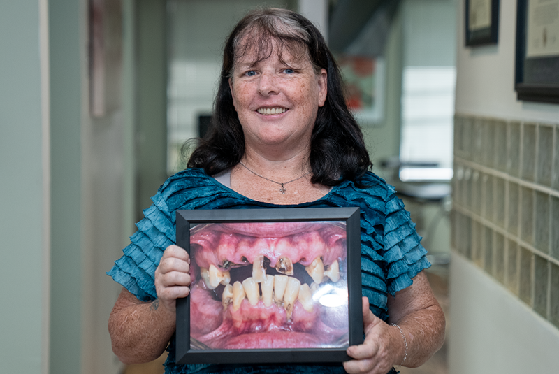 Patient Brenda smiling and holding up her before photo of rotting teeth.